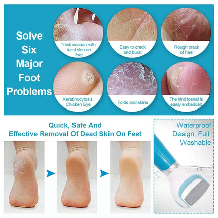 Electric Foot File Grinder Dead Skin Callus Remover for Foot Pedicure Tools Feet Care for Hard Cracked Foot Files Clean Tools bl