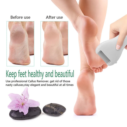 Replacements Roller Heads For Pro Pedicure Foot Care Tool Feet Electronic Foot File Rollers Dead Hard Skin Remover