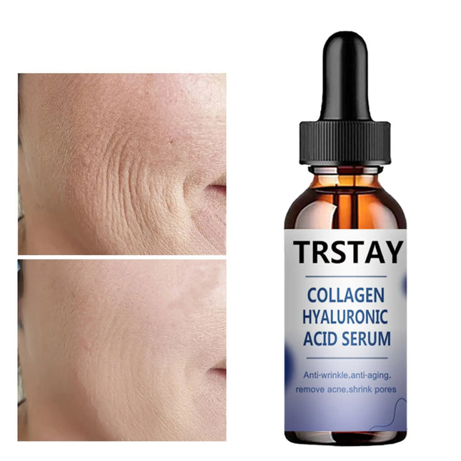 Face Skin Care Collagen Hyaluronic Acid Serum Retinol Vitamin Anti-Aging Wrinkle Moisturizing Whitening Shrink Pores