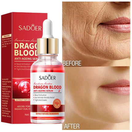 Royal Dragon Blood Serum Placenta Rejuvenation Moisturizing Smoothing Facial Firming Essence Improve Roughness Cosmetic 2024