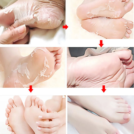 1Pair Exfoliating Foot Mask Pedicure Socks Scrub Feet Mask Remove Dead Skin Heels Foot Exfoliating Moisturizing Mask Foot Care