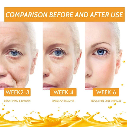 Vitamin C Remove Dark Spots face Serum Whiten Fade Freckles  Anti-wrinkle Brighten Moisturize Collagen Korean Face Care Makeup