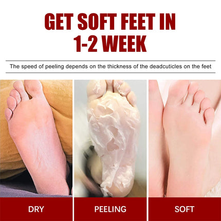 1Pair Exfoliating Foot Mask Pedicure Socks Scrub Feet Mask Remove Dead Skin Heels Foot Exfoliating Moisturizing Mask Foot Care