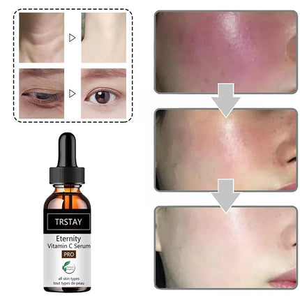 TRSTAY Vitamin C Serum for Face Moisturizing Oil Control Shrink Pores Deep Anti Wrinkle Spots Fade Fine Line