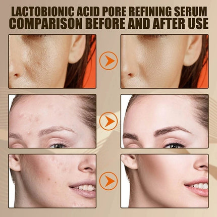 Vitamin C Remove Dark Spots face Serum Whiten Fade Freckles  Anti-wrinkle Brighten Moisturize Collagen Korean Face Care Makeup