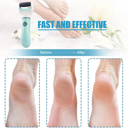 Wireless Foot Grinder USB Recharge Waterproof Anti Callus Dead Skin Cracks Pedicure Shaver Remove Dry Dead Cracked Safe Painless